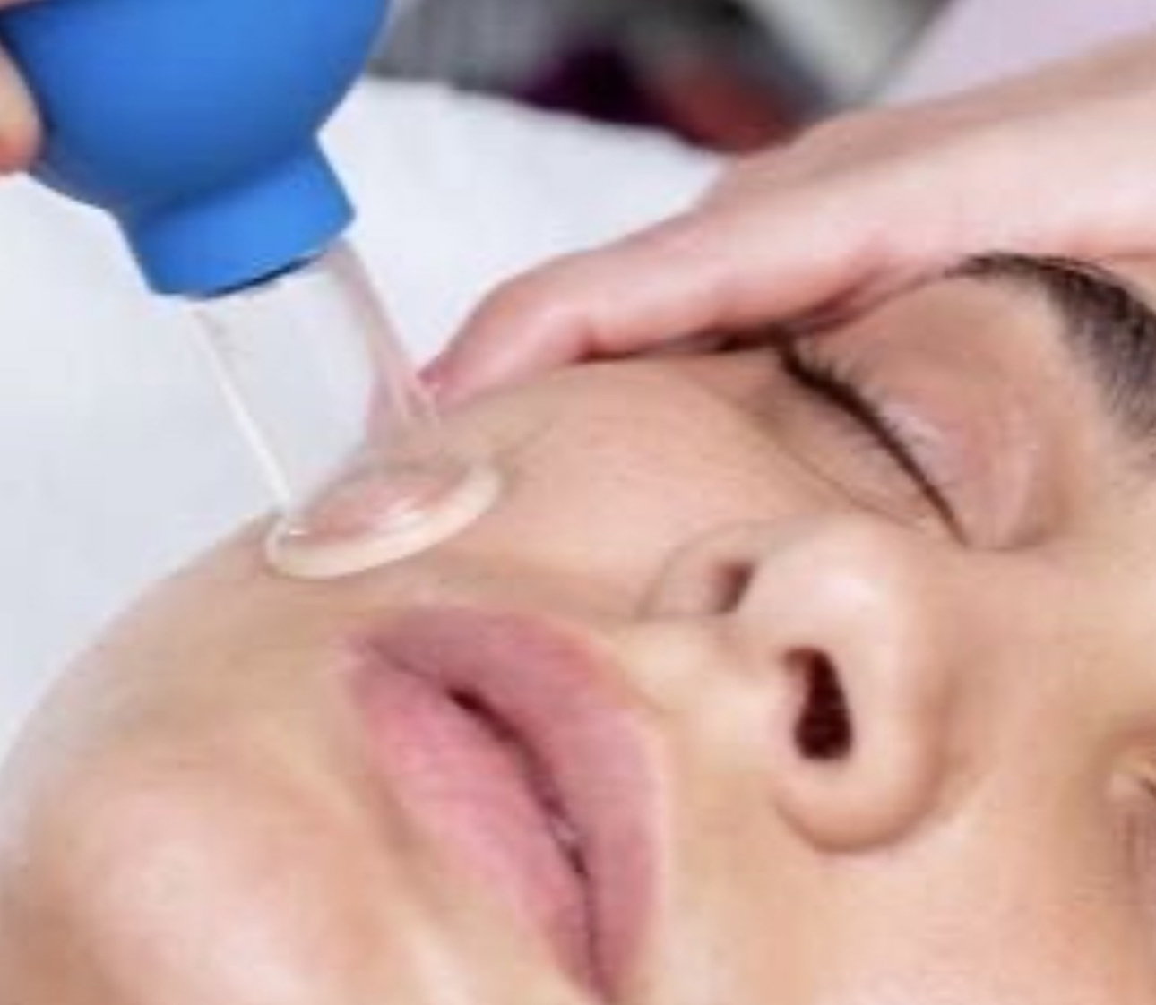 Facial Cupping Massage